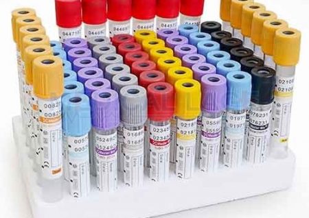 tubo-para-coleta-de-sangue-a-vacuo_1